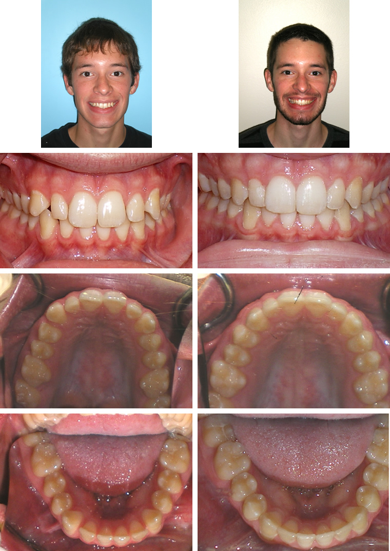 Orthodontist - Ebensburg, PA
